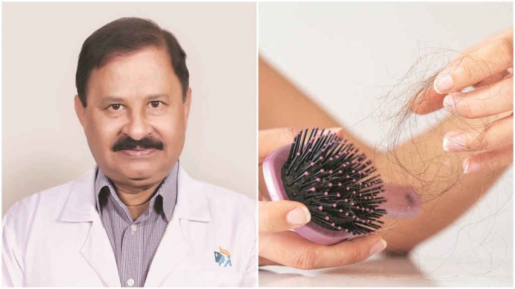 hair fall, hair fall check, roots of hair fall, hair fall symptoms,