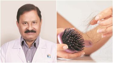 hair fall, hair fall check, roots of hair fall, hair fall symptoms,