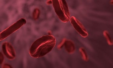 anaemia, iron deficiency, diagnostics, Iron Deficiency Day, health news, wellness news,