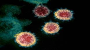 Covid 19 virus