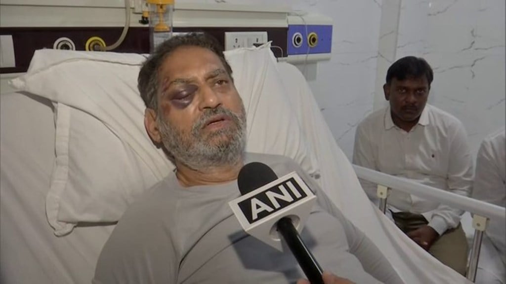 Nitin Raut has sustained injuries in his right eye, hands and legs. (Photo: ANI) Nitin Raut has sustained injuries in his right eye, hands and legs. (Photo: ANI)