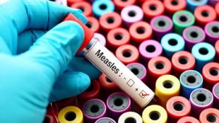 Measles, Measles Outbreak, World Health Organization (WHO), CDC, health news,