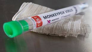 monkeypox virus symptom