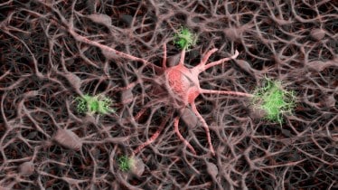 Vitamin D, dementia, Vitamin D supplements, health news, lifestyle news,