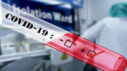 RT-PCR testing, covid 19