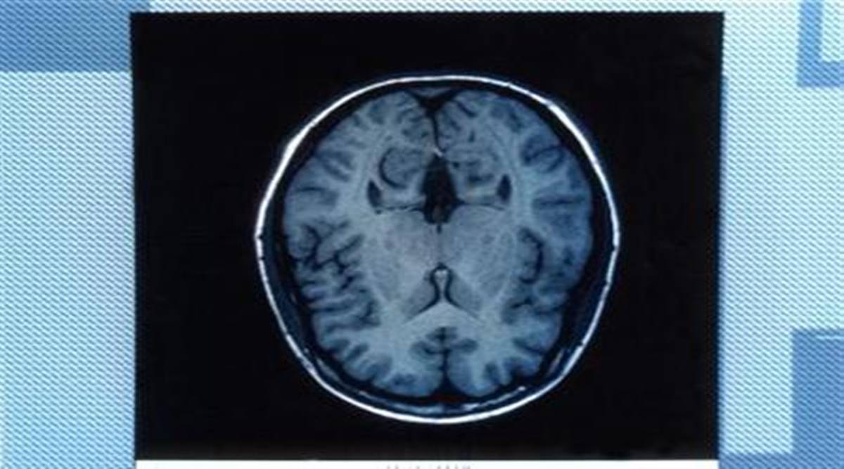 Covid pandemic altered teens’ brains, study finds - Life News | The ...