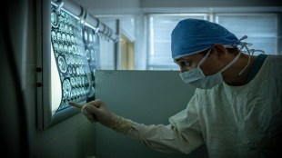 Blood tests, Alzheimer's diseases, diagnostics tests, health news, diagnostics news,