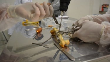 Regenerative medicines, Orthopedic surgery, surgery, healthcare, healthcare news,