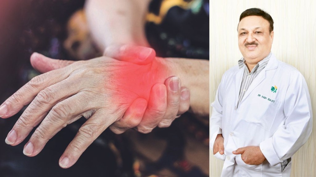 The doctor is in by Dr Yash Gulati Joint issues
