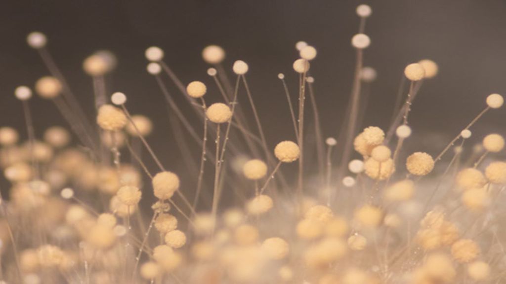 Candida Auris, drug resistant fungus, Centre for disease control and prevention, Candida Auris in US, healthcare news,