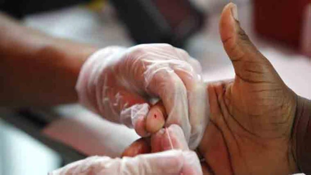 Death rates in severe diseases can reach up to 70 per cent without treatment