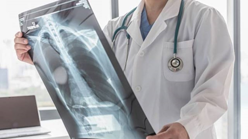 tuberculosis. health sector