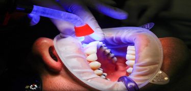 Oral health, oral care, toothpaste, colgate, colgate pamolive, healthcare news,