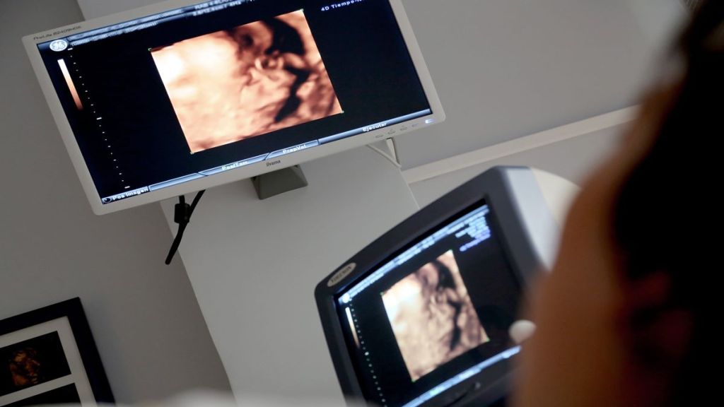 Brain surgery, fetus, rare medical conditions, rare surgery, healthcare news,