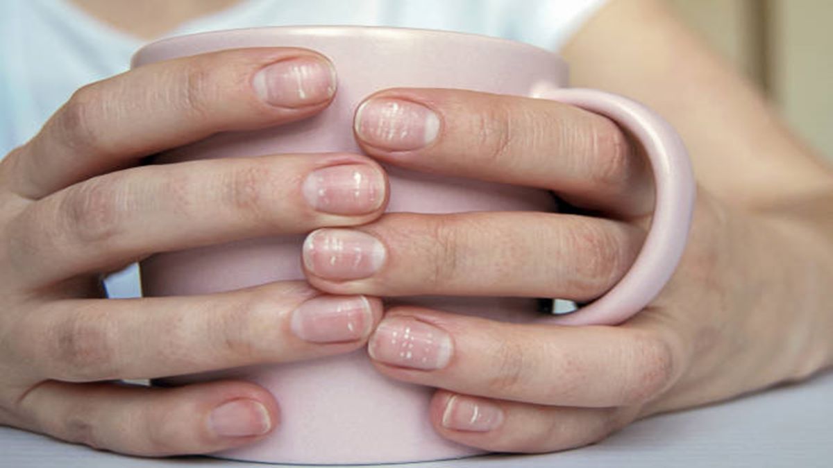 Fingernails, white spots, deficiency, anemia, healthcare news, Fingernails, white spots, deficiency, anemia, healthcare news,