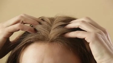Dry Scalp