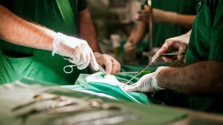 seizures, bizarre medical cases, surgery, epilepsy, healthcare news,