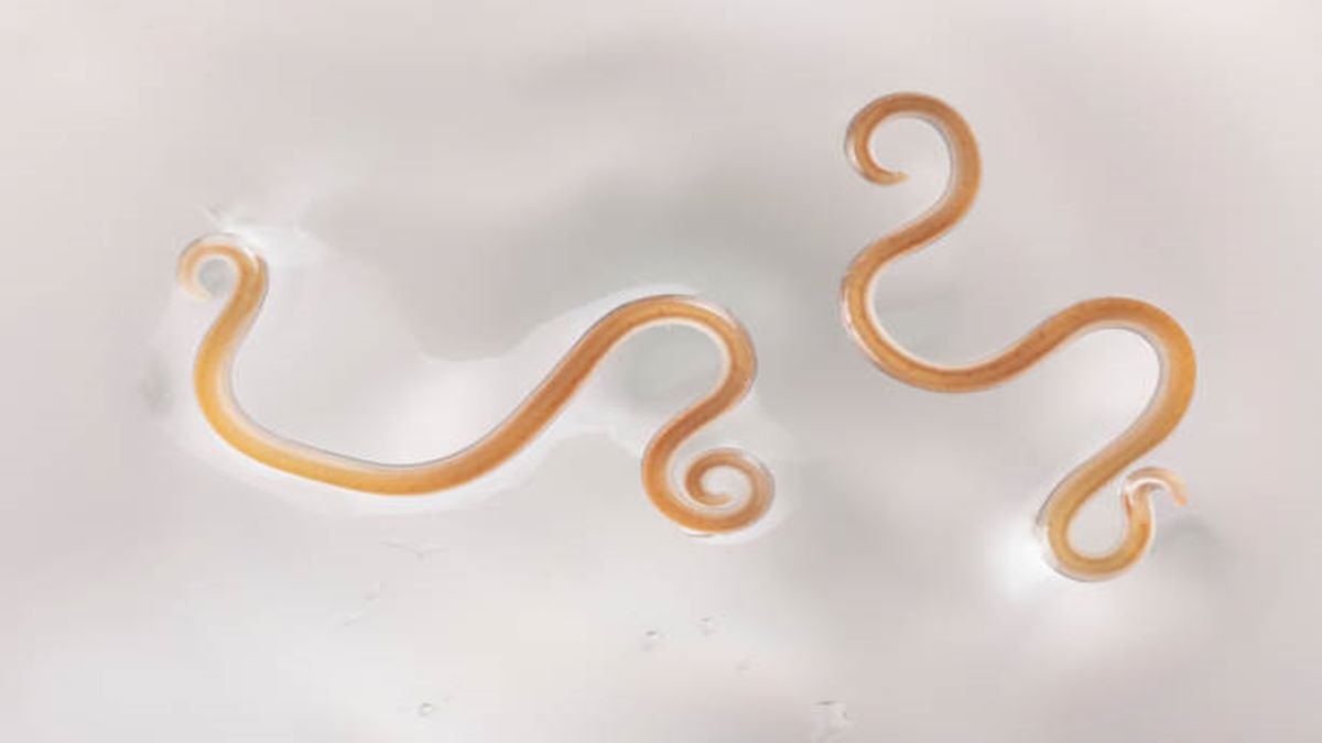 Roundworms, roundworms in brain, bizarre medical case, healthcare news, Roundworms, roundworms in brain, bizarre medical case, healthcare news,