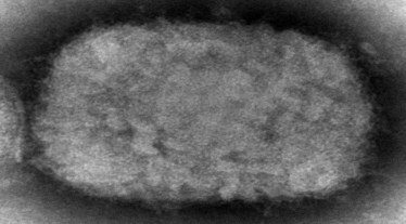 mpox, mpox in Japan, mpox deaths, mpox cases, healthcare news,