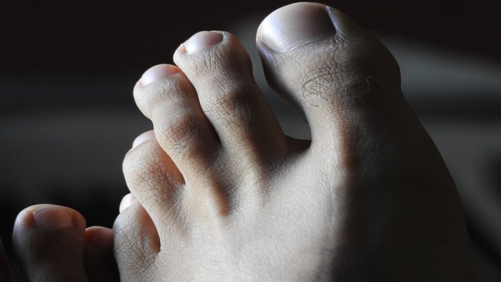 Diabetes, heart diseases, feet symptoms, feet diseases, health news, wellness news,
