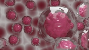 Cancer, Cancer in India, cancer symptoms, cancer care, healthcare news, cancer news,