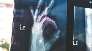 bone health, bone doctor, World Osteoporosis Day, Osteoporosis. bone disease, health news