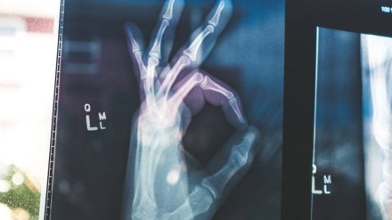 bone health, bone doctor, World Osteoporosis Day, Osteoporosis. bone disease, health news