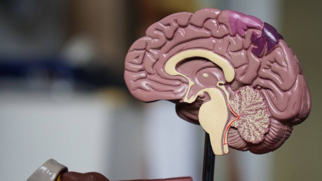 brain stroke, world stroke day, stroke day, brain stroke symptoms, stroke reasons, brain stroke treatment, health news