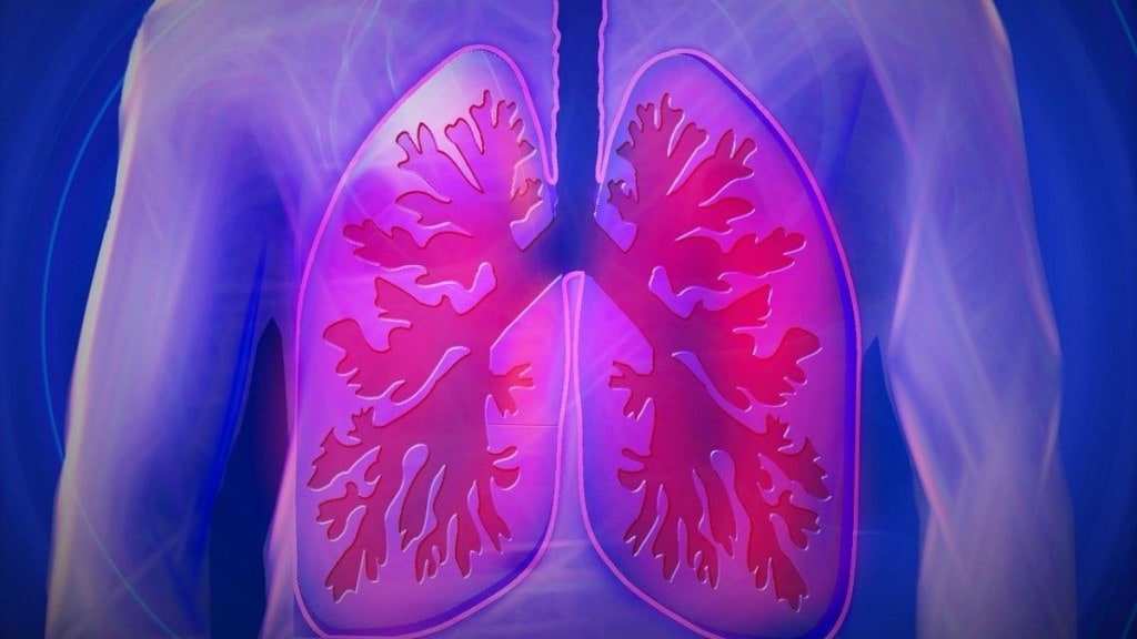 White lung syndrome, lung, respiratory illness, post-covid, covid, pandemic, illness, china, USA, america, ohio, lung disease