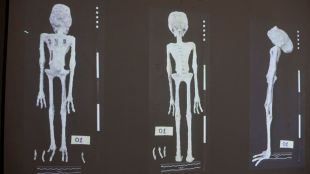 An X-rays and study carried out by the Institute of Legal Medicine of Peru on the 'alien mummies'