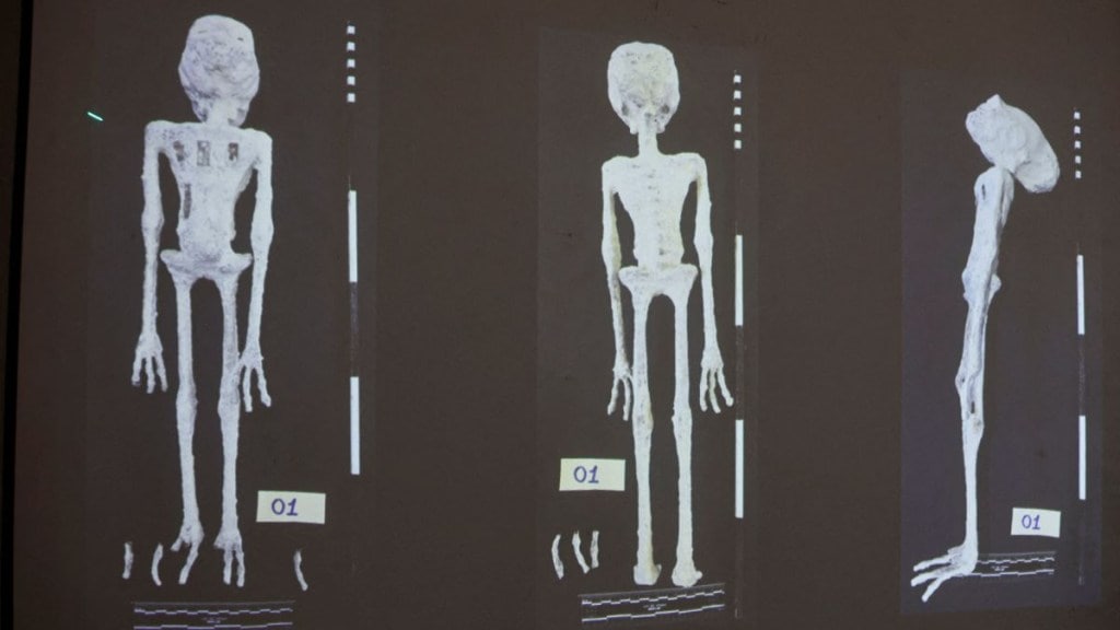 An X-rays and study carried out by the Institute of Legal Medicine of Peru on the 'alien mummies' An X-rays and study carried out by the Institute of Legal Medicine of Peru on the 'alien mummies'