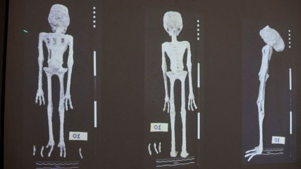 An X-rays and study carried out by the Institute of Legal Medicine of Peru on the 'alien mummies' An X-rays and study carried out by the Institute of Legal Medicine of Peru on the 'alien mummies'