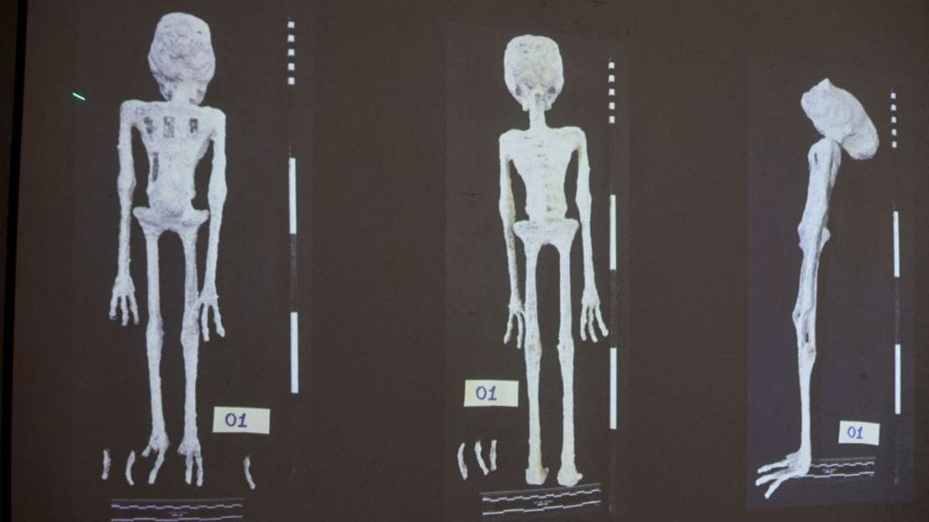 An X-rays and study carried out by the Institute of Legal Medicine of Peru on the 'alien mummies'
