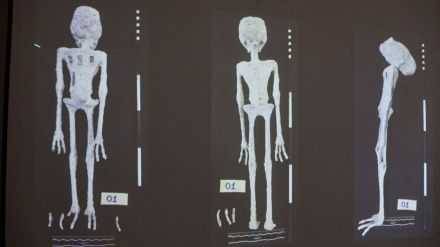 An X-rays and study carried out by the Institute of Legal Medicine of Peru on the 'alien mummies'
