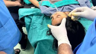 Awake Brain Surgery, Awake craniotomy, brain surgery, AIIMS, AIIMS Delhi, healthcare news,