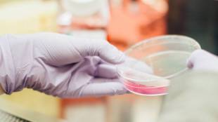 bacteria, new bacteria, new discovery, new study, scientific study, science, drug-resistant bacteria