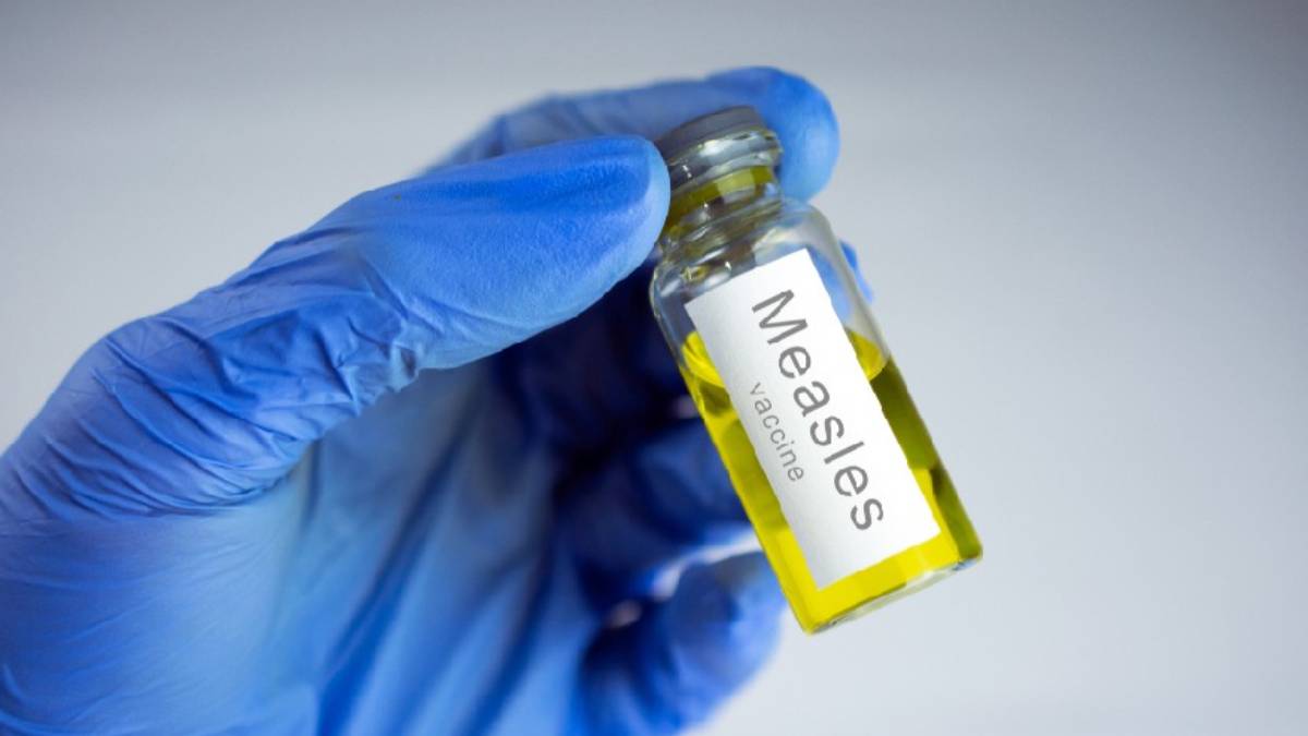 measles, mp cases of measles, measles vaccine, measles cases in india, what is measles