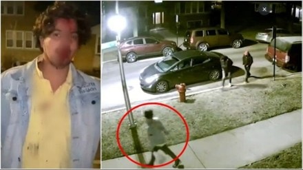 'Please help': Bleeding Indian student attacked in Chicago issues plea; wife writes to Jaishankar 'Please help': Bleeding Indian student attacked in Chicago issues plea; wife writes to Jaishankar