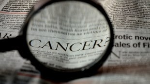 Oral cancer, head and neck cancer, oral cancer in India, head and neck cancer in India, healthcare news,