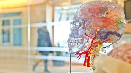 nithin kamath, nithin kamath brain stroke, brain stroke, stroke in brain, brain stroke preventive measure, zerodha ceo, zerodha ceo stroke nithin kamath, nithin kamath brain stroke, brain stroke, stroke in brain, brain stroke preventive measure, zerodha ceo, zerodha ceo stroke