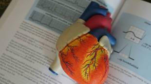 heart attack, heart attack symptoms, heart attack symptoms in women and men, heart attack symptoms in women, heart attack cases, who, healthcare news