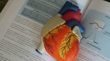 heart attack, heart attack symptoms, heart attack symptoms in women and men, heart attack symptoms in women, heart attack cases, who, healthcare news