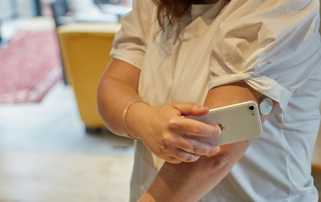 'Continuous glucose monitoring will help in achieving better control of diabetes'