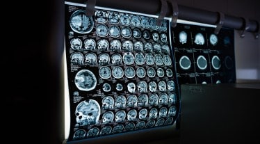 New study reveals South-Asia specific mutations associated with Parkinson's disease among younger population