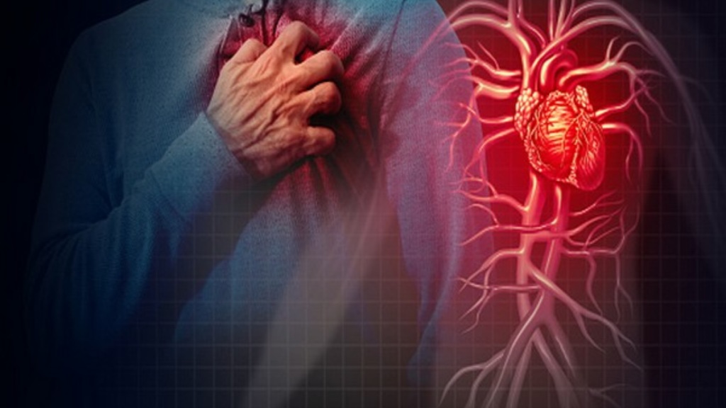 Heart disease