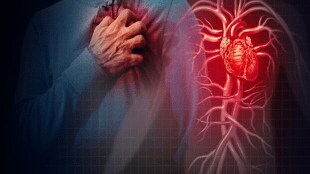 Heart disease