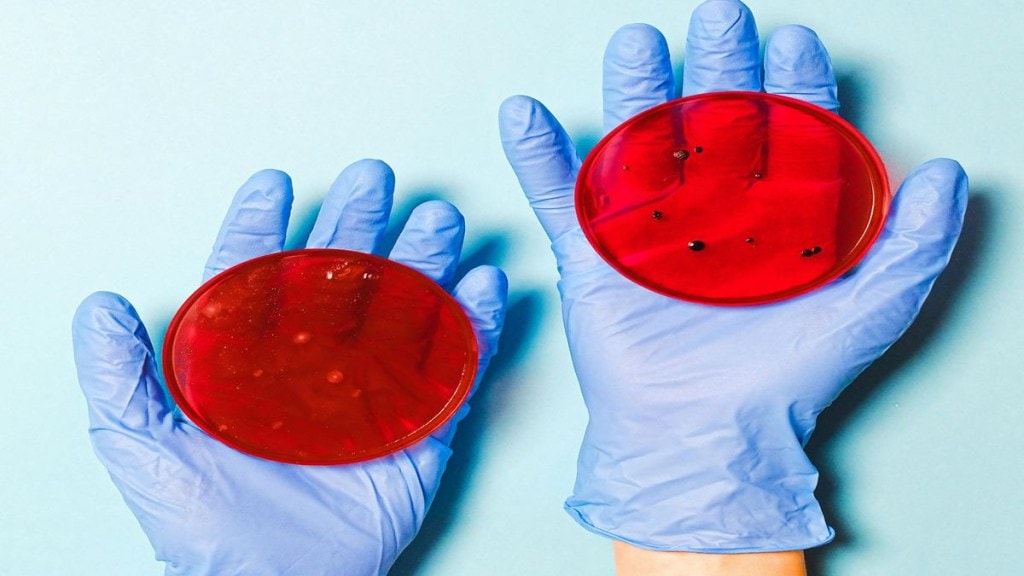 vampire bacteria, human blood bacteria, fatal infections, blood infections, healthcare news,