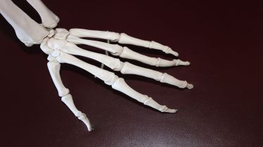 This AI tool can detect tumour cells and accurately predict bone cancer; Here's what you need to know