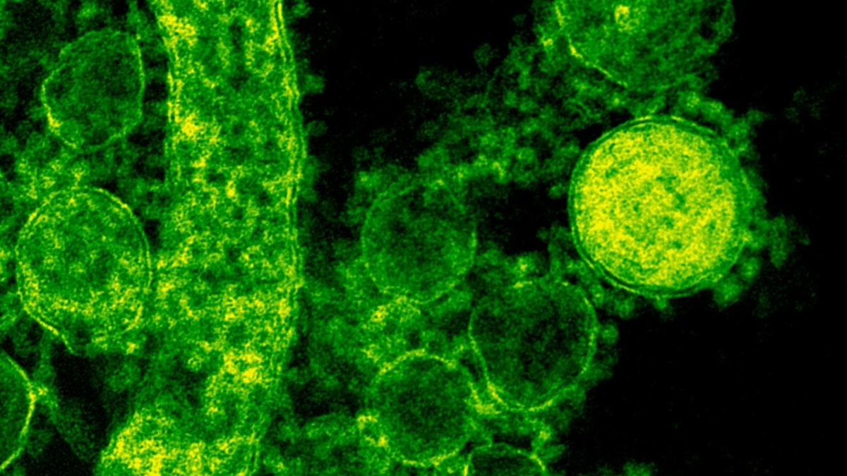 Japan, Japan news, Japan latest news, Japan health news, flesh eating bacteria