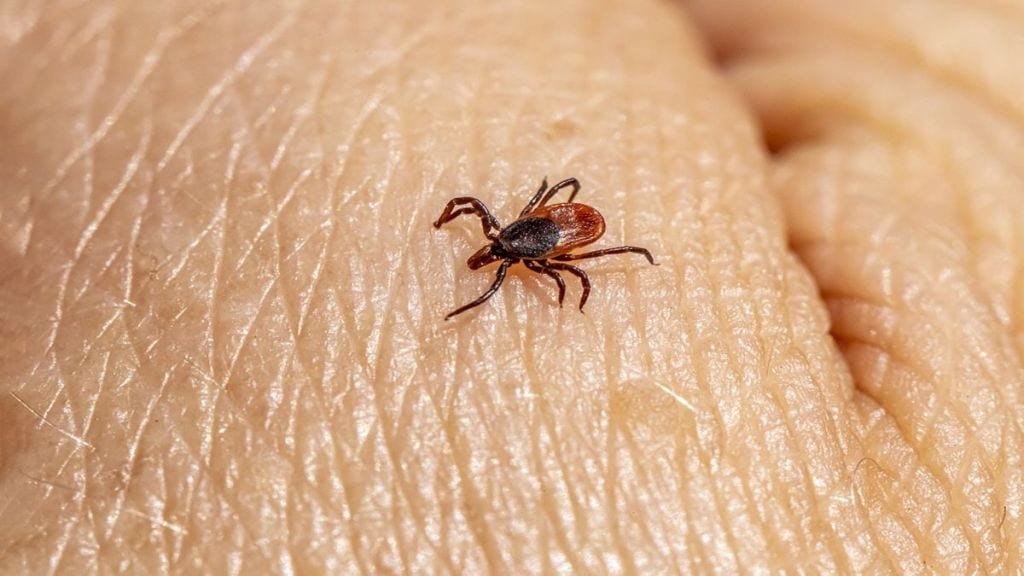 Crimean-Congo hemorrhagic fever, Crimean-Congo hemorrhagic fever virus, Ebola virus, bleeding eyes disease, Crimean-Congo hemorrhagic fever death, health news, wellness news,